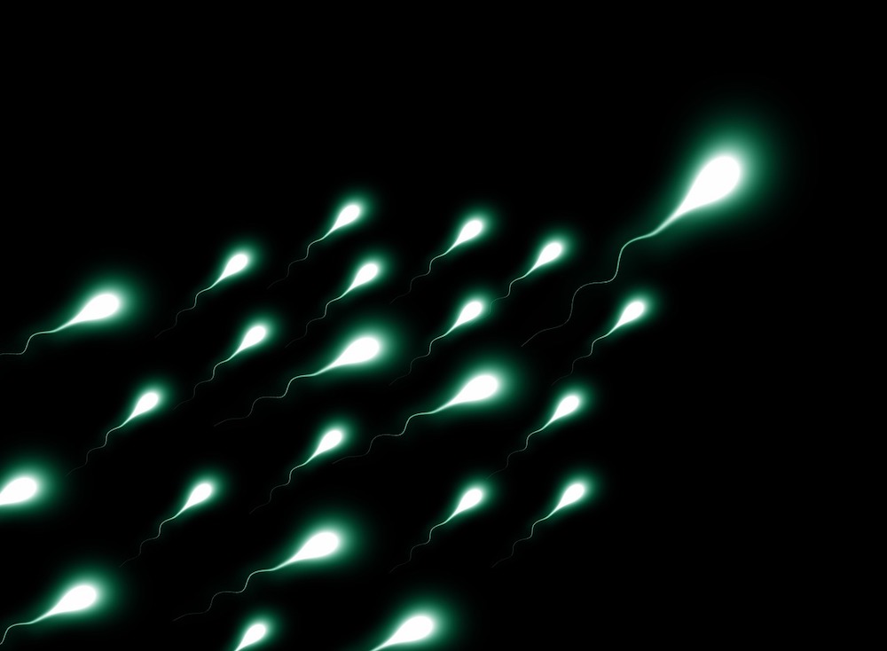 Bassa Motilità dello Sperma: Cause, Impatti e Possibili Soluzioni