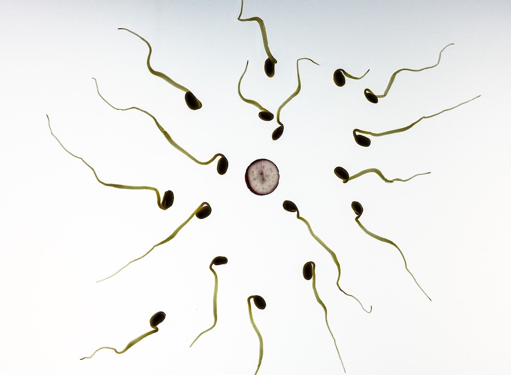 Fecondazione in vitro: Una Guida Completa alla Tecnica Riproduttiva